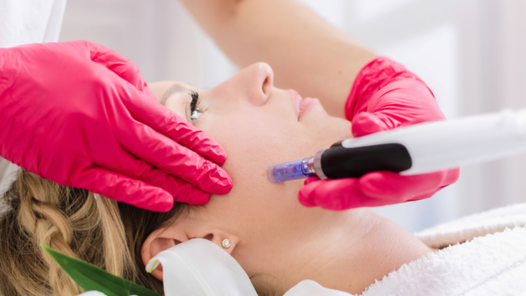 Jak Dermapen potrafi przeprogramować Twoją skórę?